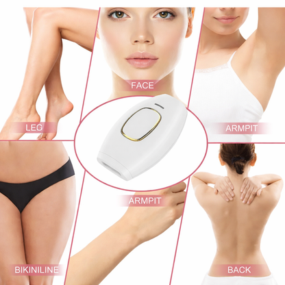 Depiladora laser